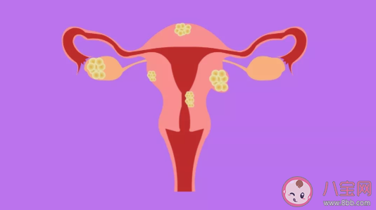微创切除子宫的副作用是什么 微创子宫切除多久能恢复