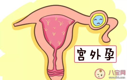 怎么提前发现宫外孕 提前发现宫外孕的症状