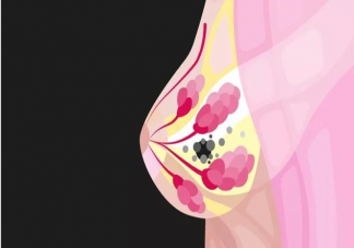 哪些行为会影响乳房健康 哪几类女性更要重视乳房健康