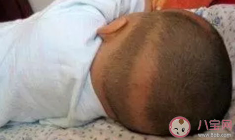 孩子枕秃是缺钙的表现吗 枕秃是什么原因引起的