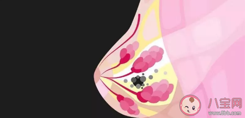 乳腺纤维瘤会变小吗  乳腺纤维瘤怎么治疗