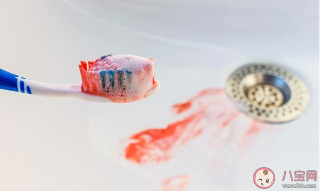 为什么刷牙时会出血 牙龈出血了怎么办