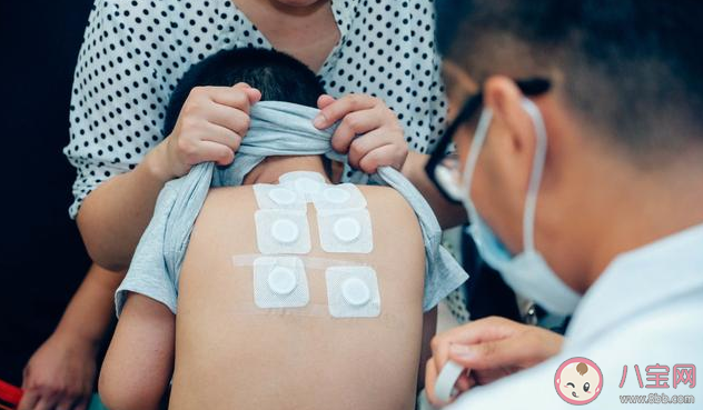 2020三伏贴几月份开始贴 孩子贴三伏天皮肤过敏灼伤是怎么回事