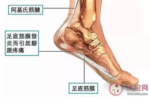 脚后跟疼是什么原因导致的 脚后跟疼怎么治疗