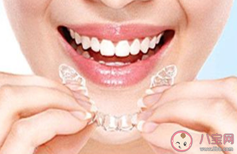 牙洞补牙要戴牙套吗 什么样的补牙情况要戴牙套