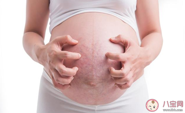 孕期肚子小不会长妊娠纹吗 妊娠纹和肚子大小有关吗