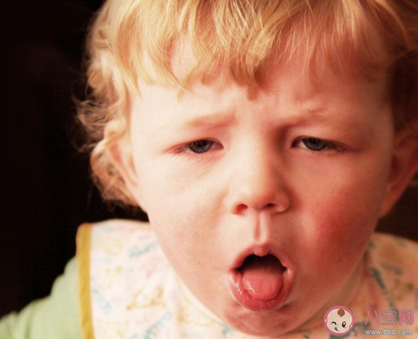 孩子咳嗽需要忌口吗 咳嗽的时候不能吃什么食物