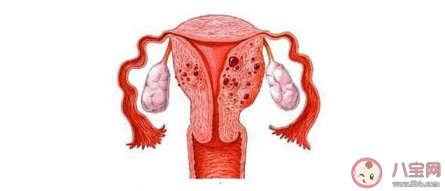 子宫肌瘤和子宫腺肌瘤有什么区别 子宫肌瘤和子宫腺肌瘤一样吗