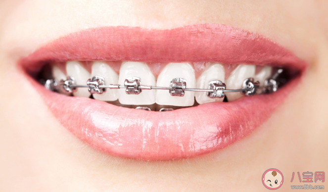 矫正牙齿|矫正牙齿对脸型的影响大吗 哪几类人牙齿矫正脸型变化最大