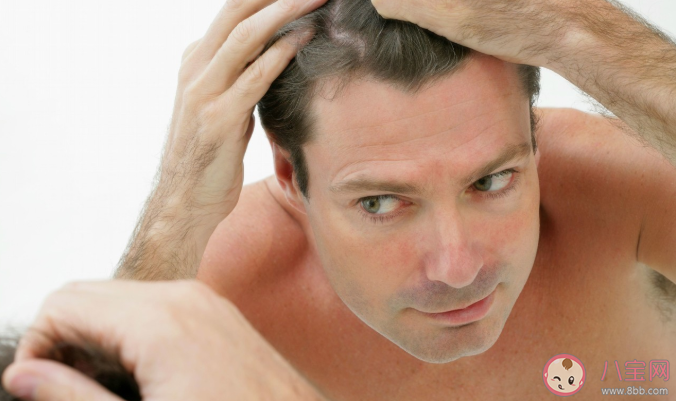 健身多了真的会导致脱发吗 怎么拯救头发预防脱发