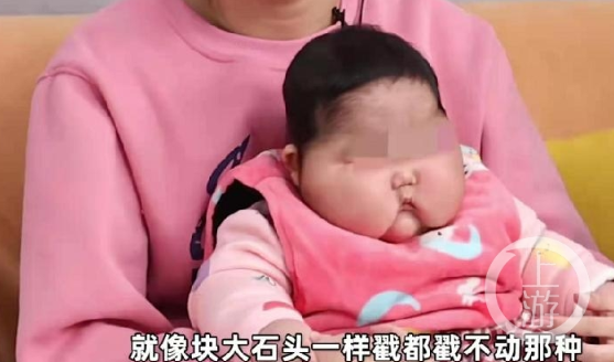 5月大婴儿|5月大宝宝用婴儿霜变大头娃娃是真的吗 是抑菌霜引起的吗