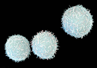 化疗白细胞降低怎么办 白细胞下降会有什么危害后果