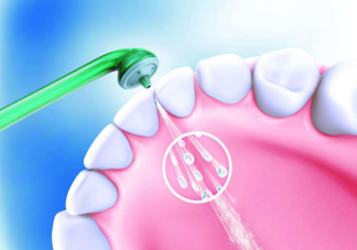 牙缝清洁会带来哪些好处 如何正确清洁牙缝