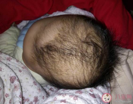 宝宝脱发是正常现象吗 宝宝头发护理法则