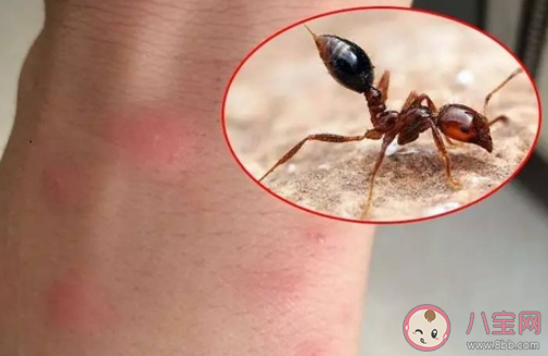 被红火蚁咬伤有哪些表现 咬伤后应该如何紧急处理