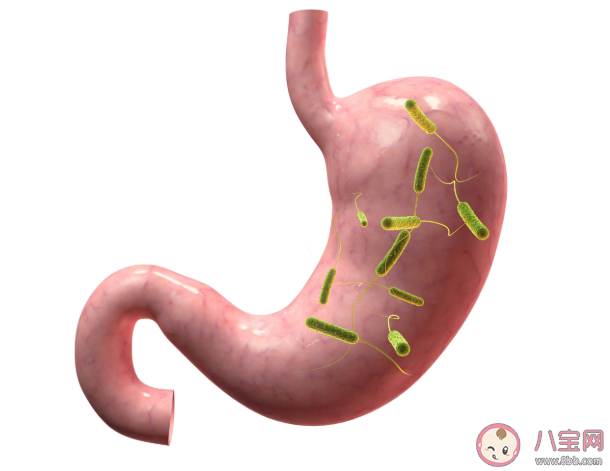 常见胃病症状有哪些 ​如何正确养胃护胃