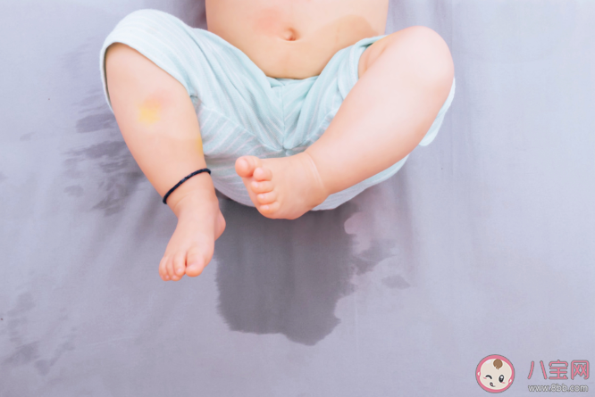 足外翻对孩子有什么影响 如何预防宝宝足外翻