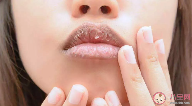 唇部干裂有死皮怎么清理 唇部护理方法技巧