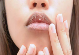 唇部干裂有死皮怎么清理 唇部护理方法技巧