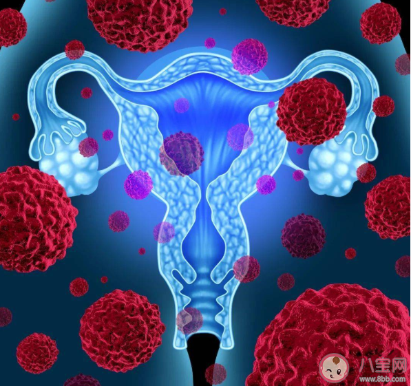 为什么卵巢癌被称为妇癌之王 卵巢癌会反复复发吗