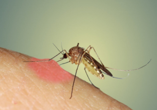 蚊子叮在身体的哪个部位最痒 如何快速止痒消肿不留疤