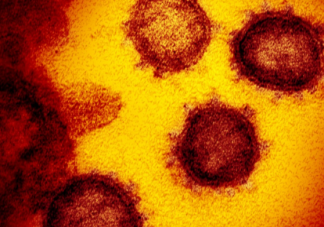 美国近20年来出现首例猴痘病毒病例 猴痘病毒有什么症状表现