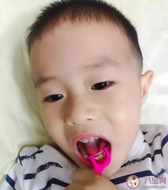 需要给孩子买儿童专用的牙线吗 什么时候给孩子使用牙线