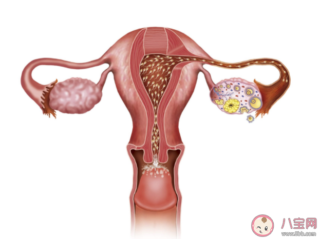 卵巢囊肿哪些能吃哪些不能吃 卵巢囊肿在饮食上要注意什么