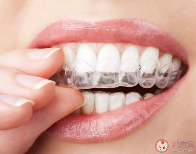 隐形牙套怎么清洁 戴隐形牙套需要用正畸清洁片吗