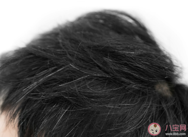 白头发如何缓解或减少 哪些原因头发会变白