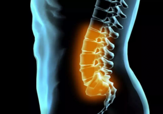 腰椎间盘突出症什么时候需要手术 腰腿痛是腰椎间盘突出症吗