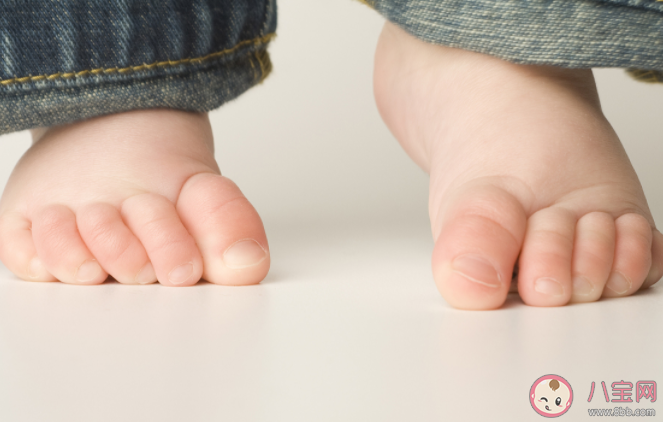孩子扭伤脚踝的正确做法是什么 如何预防扭伤脚踝