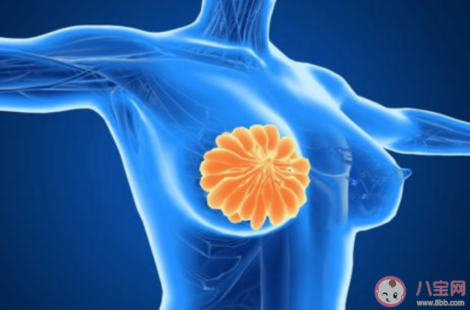 乳腺结节会变成乳腺癌吗 哪种乳腺结节需要处理