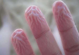 手指在水里泡久了为什么会变皱 为什么只是手指尖发皱