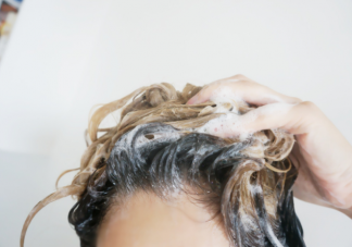 防脱洗发水真的有用吗 米诺地尔真的可以生发吗