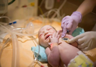 新生儿评分多少是正常的 新生儿评分的标准是什么