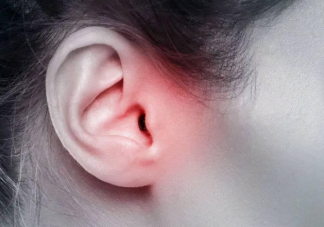 耳垂上有折痕是有心脏疾病吗 怎么根据耳朵看健不健康