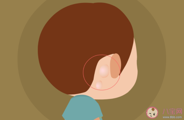 小孩有淋巴结正常吗 儿童淋巴结哪种情况要引起重视