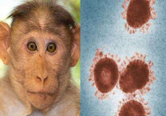 猴痘病毒会人传人吗 猴痘病毒的潜伏期是多长