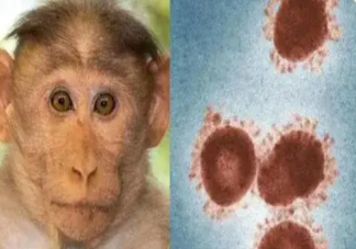猴痘病毒发生人际传播如何保护自己 怎样防止被猴痘病毒感染