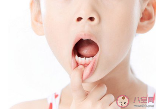 医生称孩子换牙期自行拔牙不可取 孩子换牙期该怎么做
