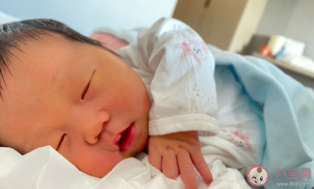宝宝黄疸一般会在什么时候出现 宝宝黄疸多长时间才能消退