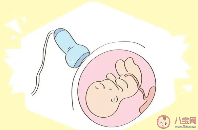 正常的胎心|正常的胎心大概是多少 怎么做胎心监护才能一次性过
