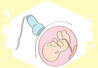 正常的胎心大概是多少 怎么做胎心监护才能一次性过