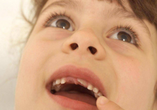 乳牙牙缝大需要担心吗 婴儿牙齿为什么缝隙这么大