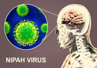 尼帕病毒到底是什么 感染尼帕病毒的症状有哪些
