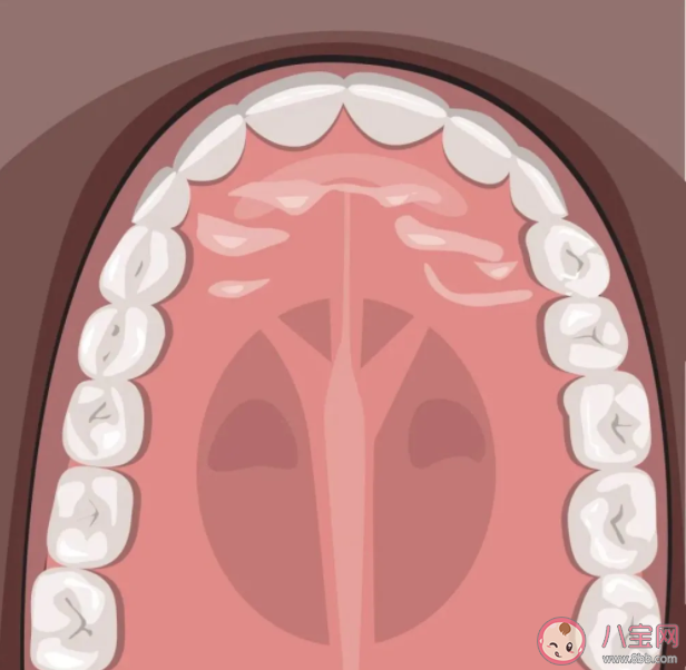 后牙槽|后牙槽上有黑线是什么 窝沟封闭可以预防窝沟龋坏吗