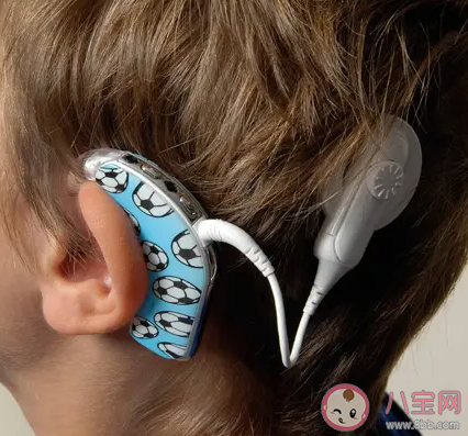 人工耳蜗|人工耳蜗为什么那么贵 装人工耳蜗能达到正常人的听力吗