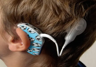 人工耳蜗为什么那么贵 装人工耳蜗能达到正常人的听力吗