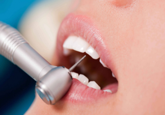 洗牙会不会有危害 洗牙后牙齿酸软怎么回事